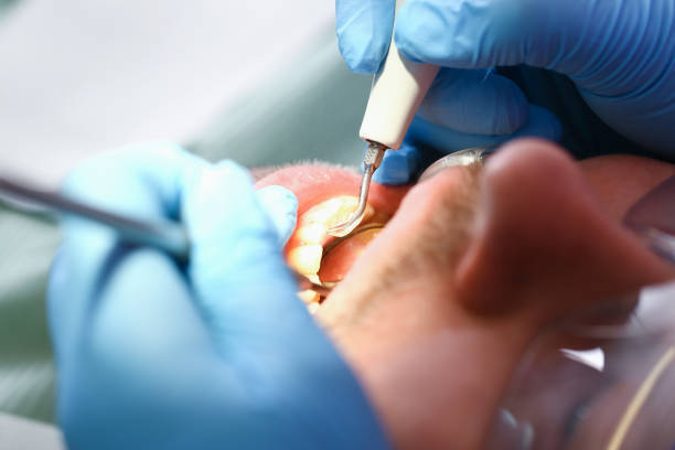 Best Walk-In Emergency Dental Services in Perry Hall, MD